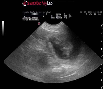 Ultrasound-1