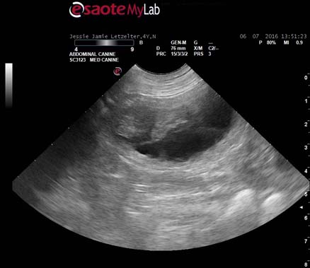 Ultrasound-3