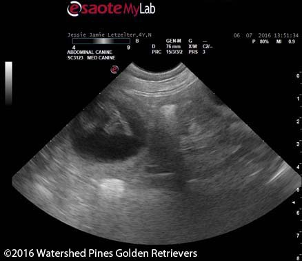 Ultrasound-4