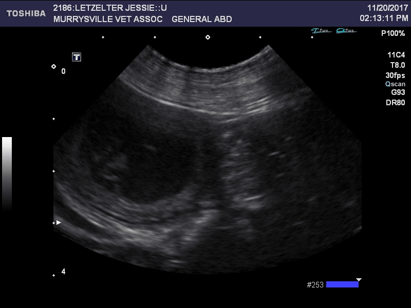 Ultrasound Image 0