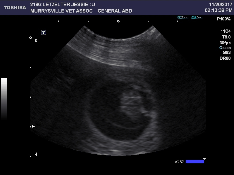 Ultrasound Image 2